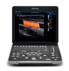 Mindray Z60 Medical Ultrasound